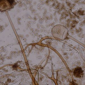 Analyse mycologique (champignons)